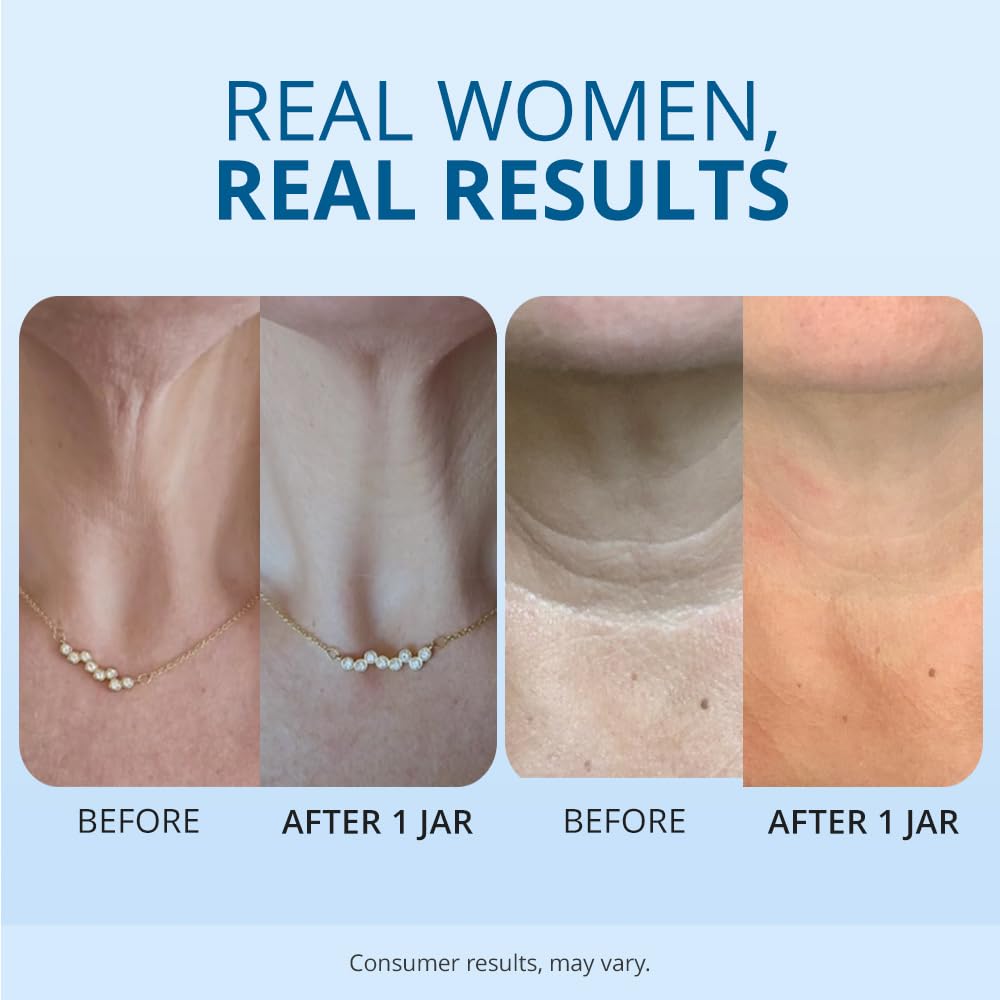Lanvoy™ Neck Chest Firming Cream