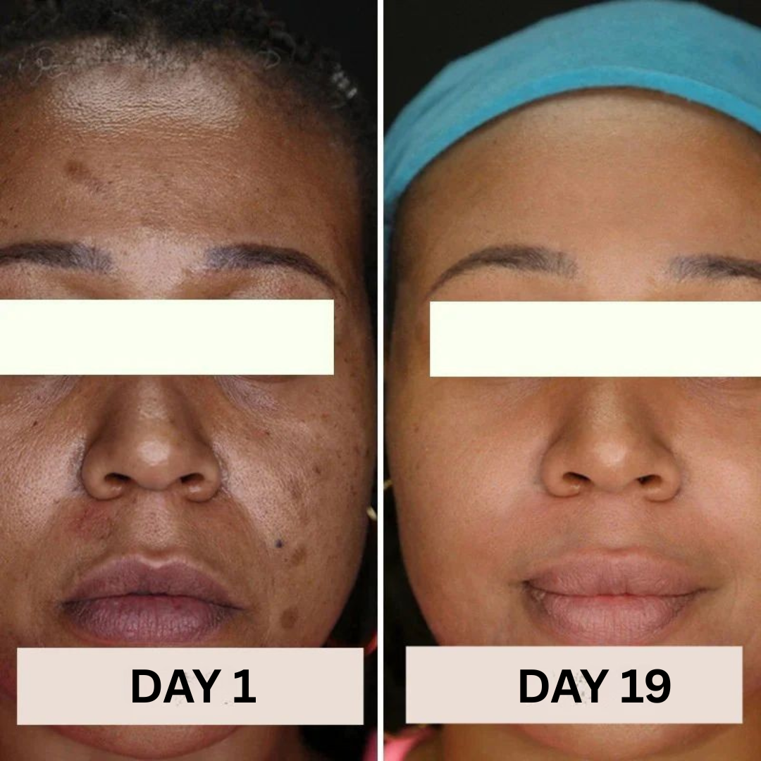 JIYU™ Radiance Renewal Toner Pads