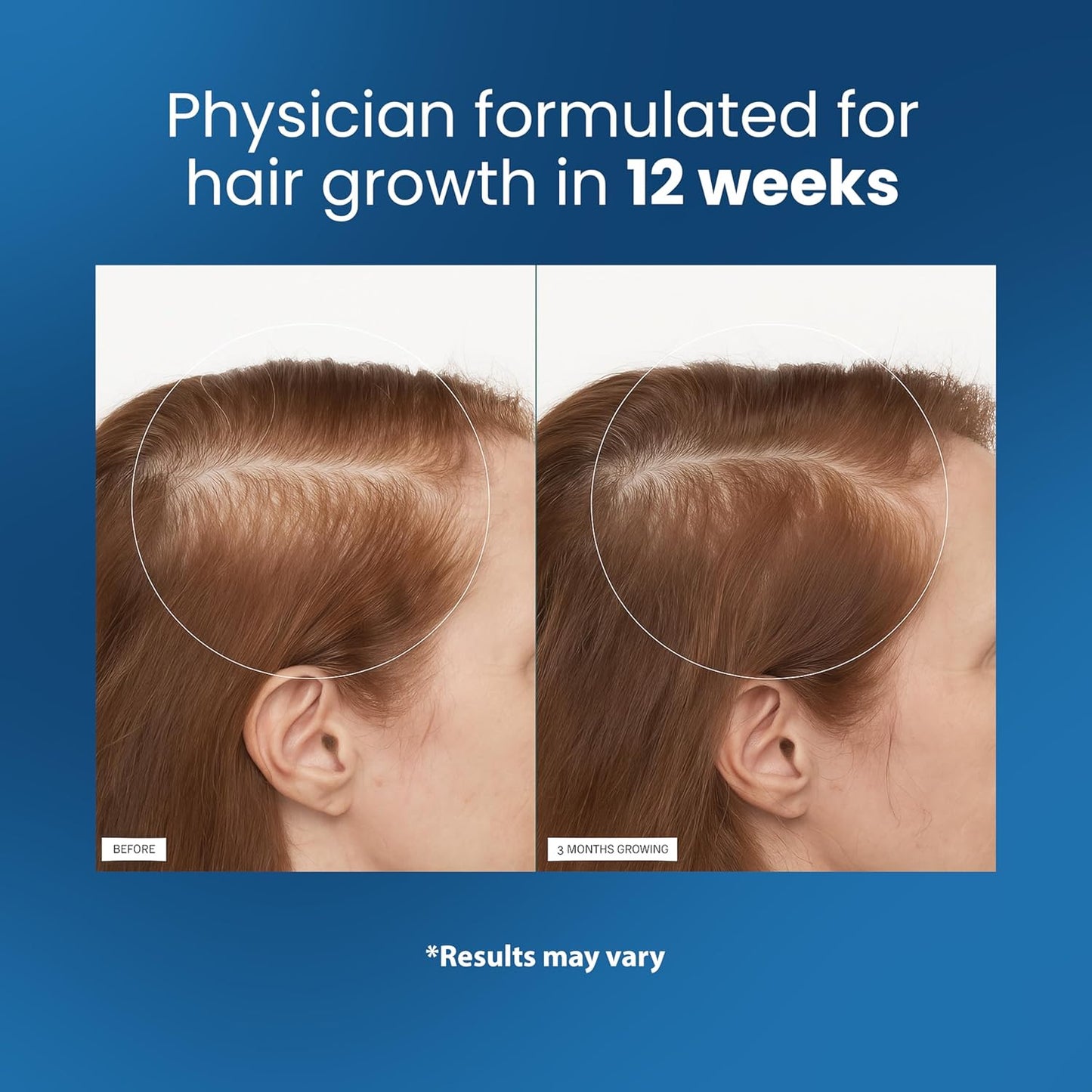Revitalize Hair Growth Roll-On™
