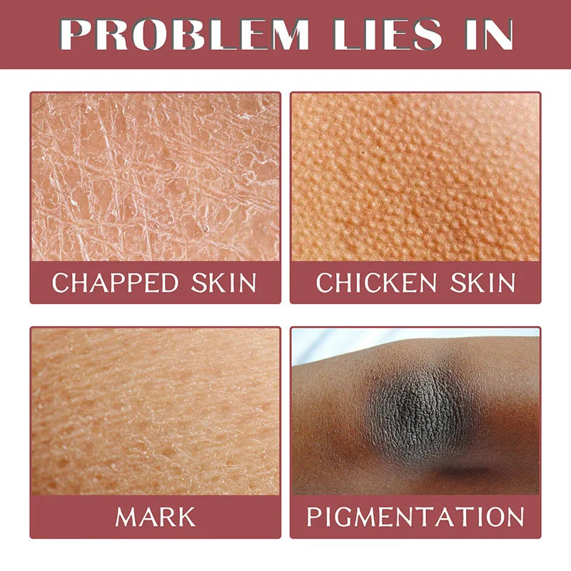 Gentle Radiance Exfoliating Gel™