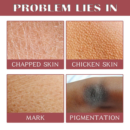 Gentle Radiance Exfoliating Gel™