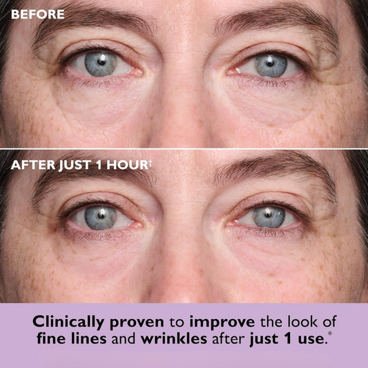 Instant Collagen Lift Eye Patches™ (8 Pairs)
