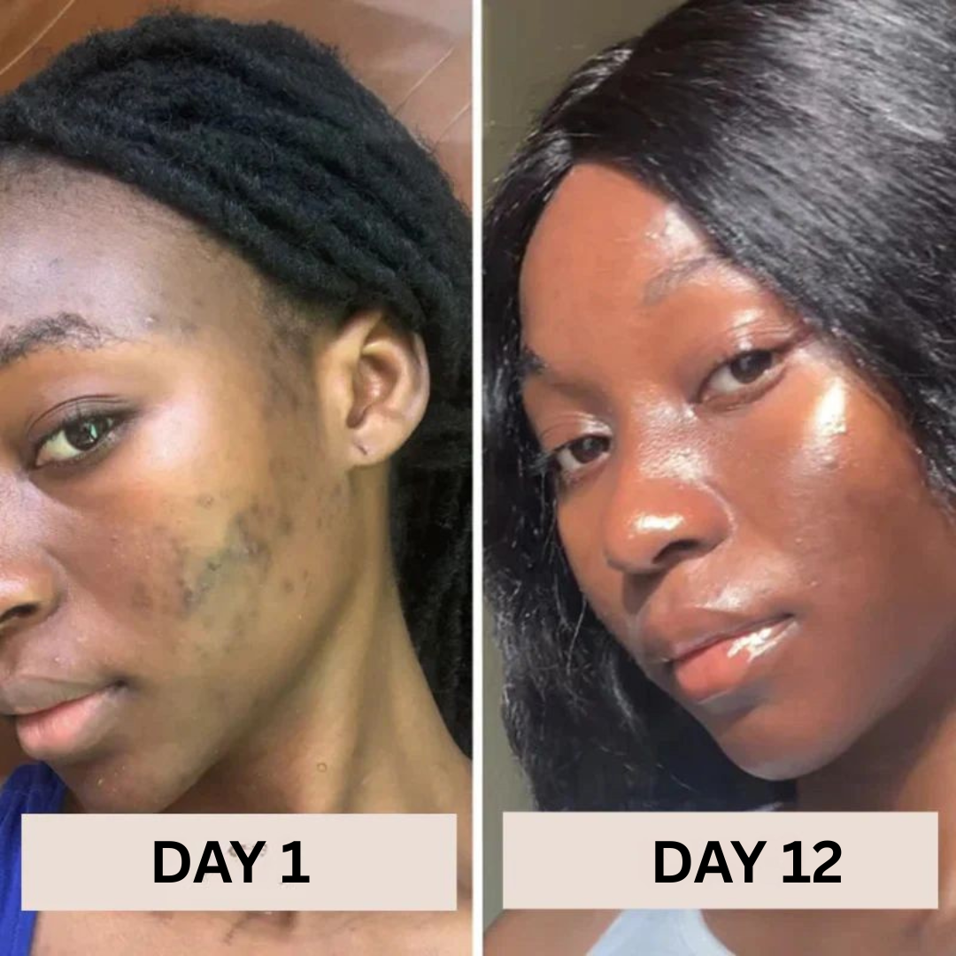 JIYU™ Radiance Renewal Toner Pads