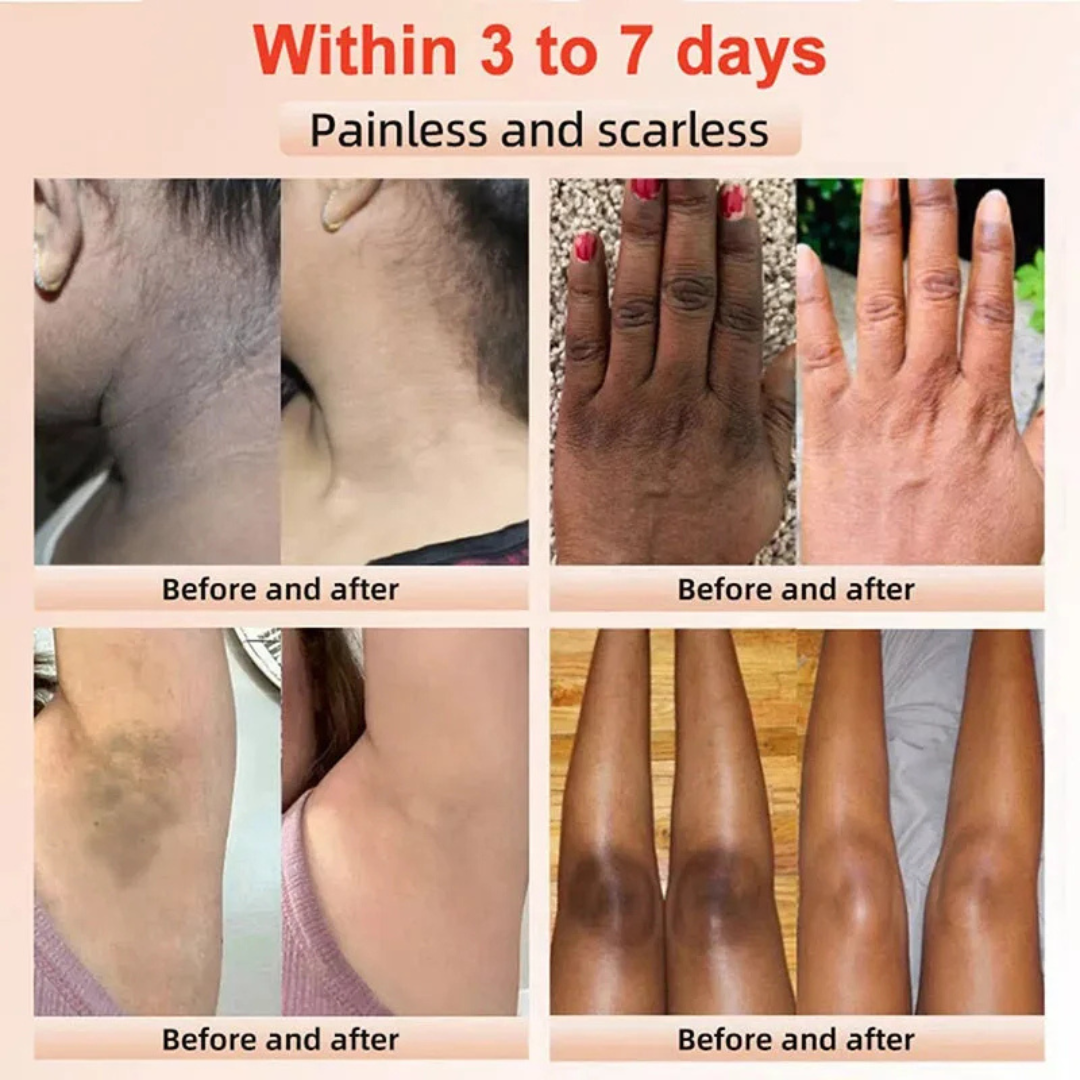 Gentle Radiance Exfoliating Gel™