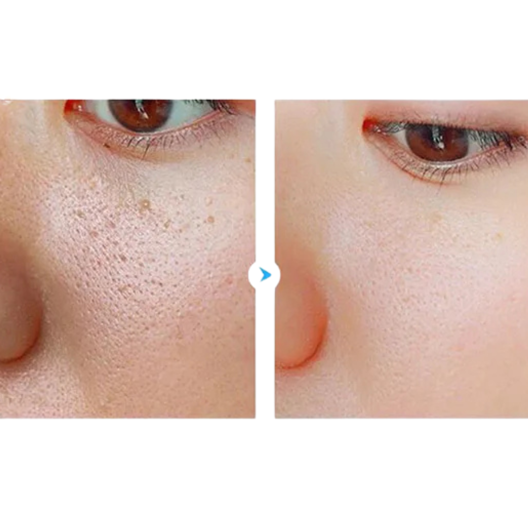 Gentle Radiance Exfoliating Gel™